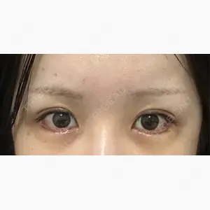 エターナル美容クリニック口コミ