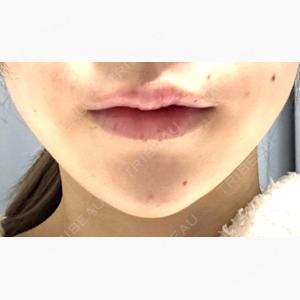 HAAB×DREAM BEAUTY CLINIC 大阪梅田院口コミ