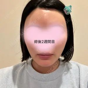 脂肪吸引の森クリニック東京院口コミ