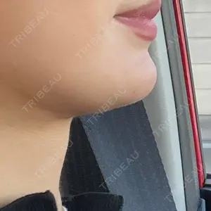 ICON CLINIC口コミ