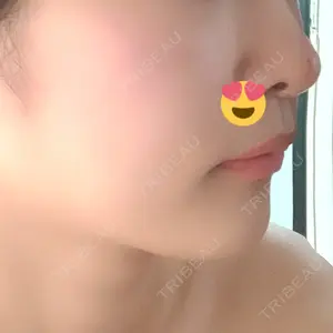 リッツ美容外科 東京院口コミ