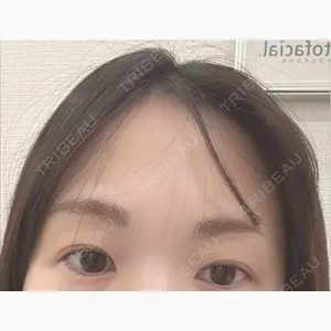 DAILY SKIN CLINIC 福岡院口コミ