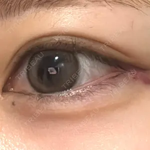 ルラ美容クリニック 仙台院 / ルラスキンクリニック 仙台院口コミ