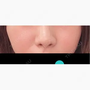 HAAB BEAUTY CLINIC 名古屋院口コミ