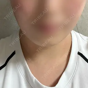 ヴェルトラクリニック 新宿院口コミ