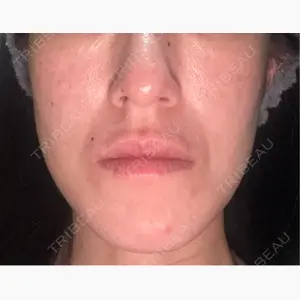 スマートスキンクリニック 横浜院口コミ