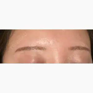 design beauty clinic 梅田本院口コミ