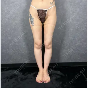 AVAN TOKYO 銀座脂肪吸引 クリニック口コミ