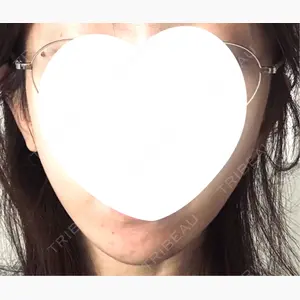 Zetith Beauty Clinic 池袋院口コミ