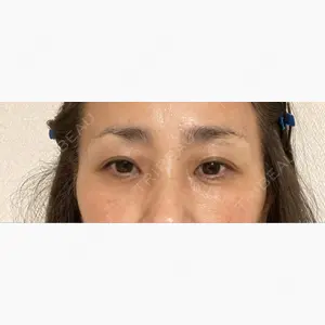 銀座みゆき通り美容外科 大阪梅田院口コミ