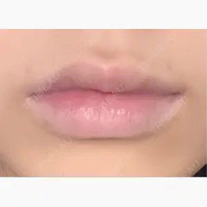 ルラ美容クリニック 大阪心斎橋院口コミ