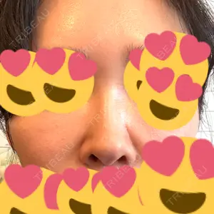 HAAB×DREAM BEAUTY CLINIC 東京本院口コミ