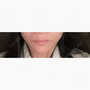 TCB東京中央美容外科 藤沢院口コミ