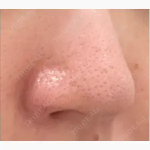 シエルクリニック口コミ