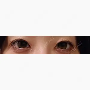 札幌美容外科ネビュラクリニック口コミ