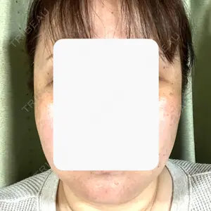 Jfeel（ジェイフィール）クリニック-ホンデ院口コミ