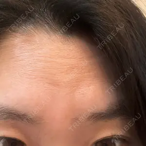 PRO CLINIC プロクリニック 銀座院口コミ