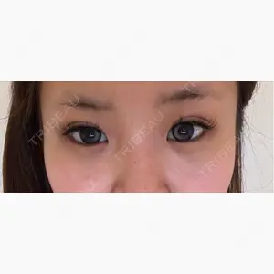 R Beauty CLINIC 銀座院口コミ