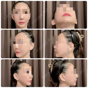 タシピウム整形外科口コミ