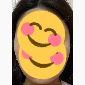 東京ココセランクリニック口コミ