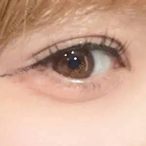 R Beauty CLINIC 銀座院口コミ