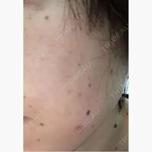 ルラ美容クリニック 仙台院 / ルラスキンクリニック 仙台院口コミ