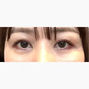 ハナビューティークリニック口コミ