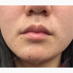 東京シルククリニック 東京神田院口コミ