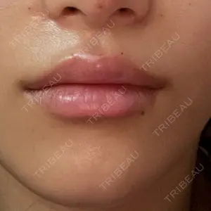 HAAB×DREAM BEAUTY CLINIC 大阪梅田院口コミ