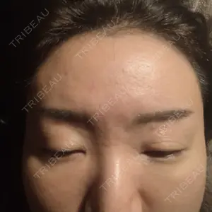 東京ココセランクリニック口コミ