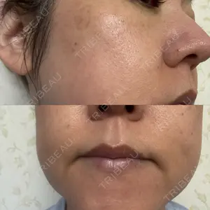 ルラ美容クリニック 高田馬場院口コミ