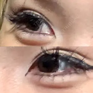 PRO CLINIC プロクリニック 銀座院口コミ