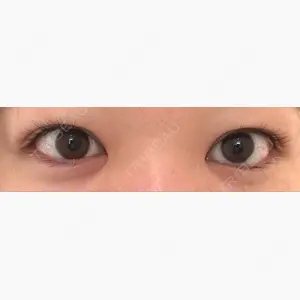 青山外苑前クリニック口コミ