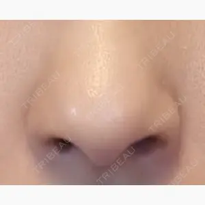 聖心美容クリニック 六本木院口コミ