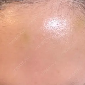 eクリニック 福岡院口コミ