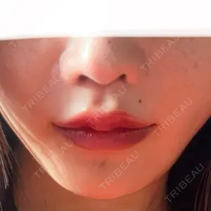 東京美容医療クリニック 池袋院口コミ