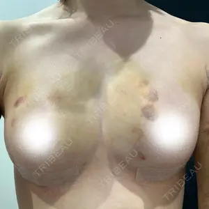 R Beauty CLINIC 銀座院口コミ