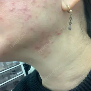 TCB東京中央美容外科 銀座有楽町院口コミ