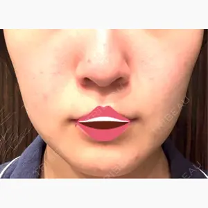 湘南美容クリニック 渋谷院口コミ