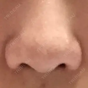 共立美容外科 高松院口コミ