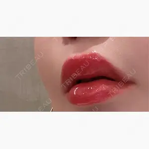 麻布十番クレールデンタルクリニック口コミ