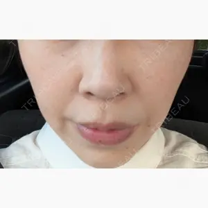 ルラ美容クリニック 岡山院口コミ