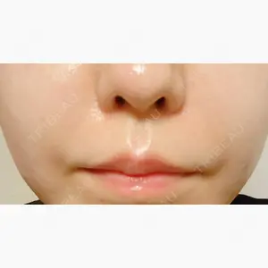 ルラ美容クリニック 広島院口コミ