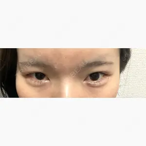 TCB東京中央美容外科 渋谷西口院口コミ