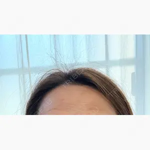 DAILY SKIN CLINIC 福岡院口コミ