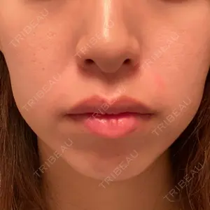 エースクリニック 大阪梅田HEPナビオ院口コミ