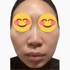 美容皮膚科エルムクリニック 麻布院口コミ