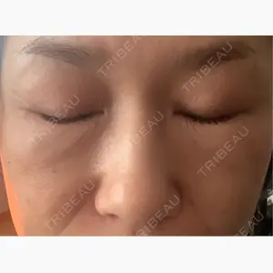 Chloe Cheongdam Clinic （クロエチョンダムクリニック）口コミ