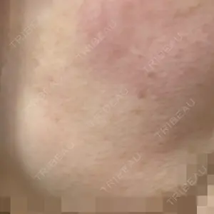 銀座みゆき通り美容外科 大阪梅田院口コミ