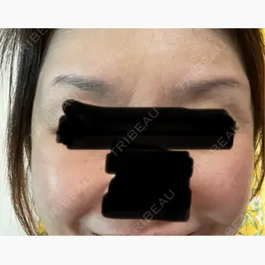 ハナビューティークリニック口コミ